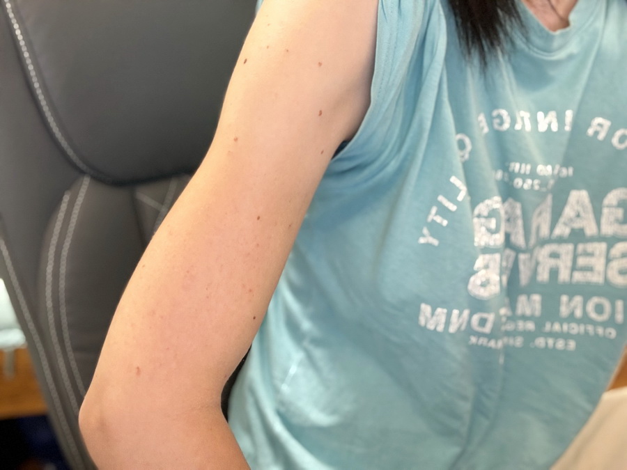 banánový balzám Medarek - účinky před a po